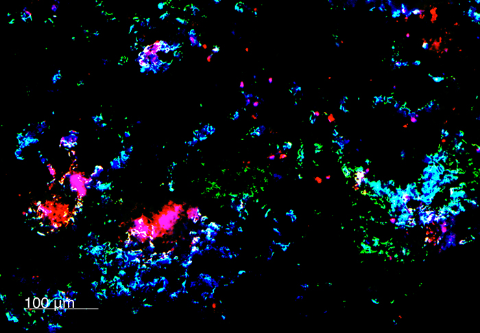 triple-negative breast cancer cells